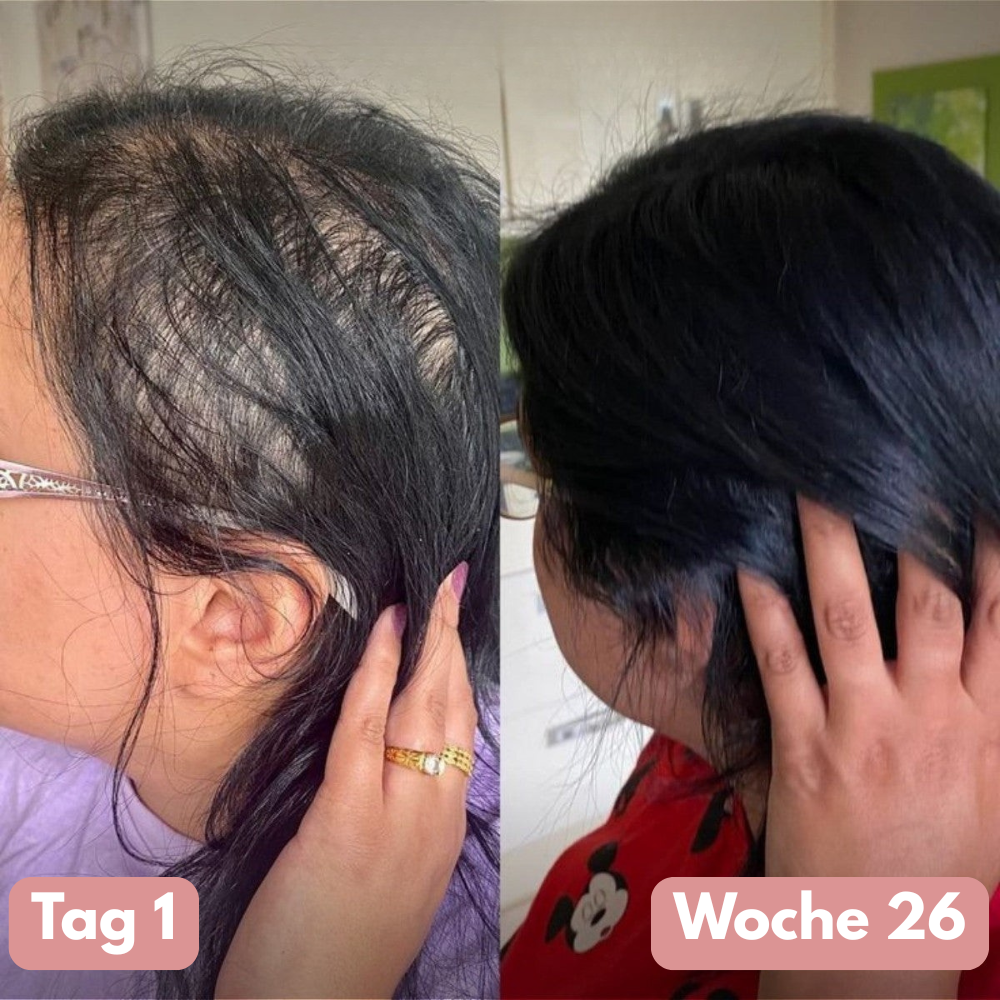 SIFIGUR Kürbiskernöl-Softgels