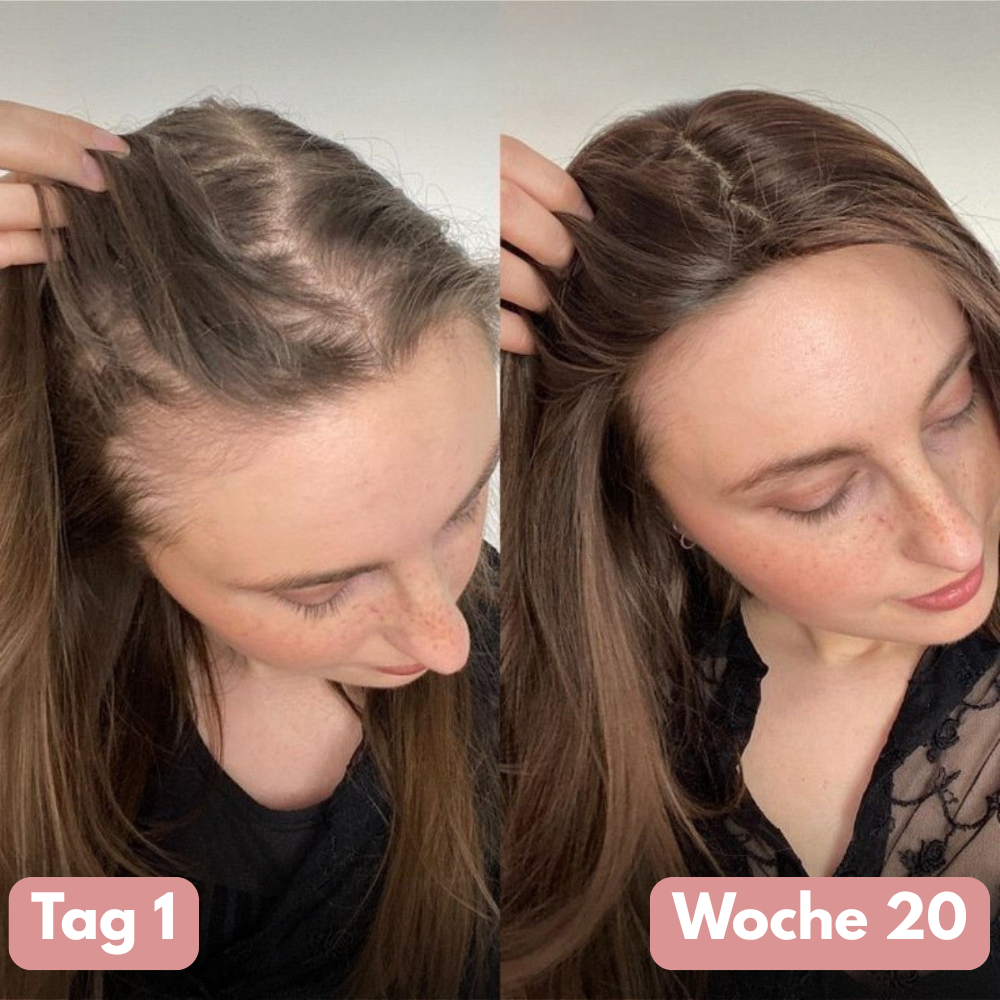 SIFIGUR Kürbiskernöl-Softgels